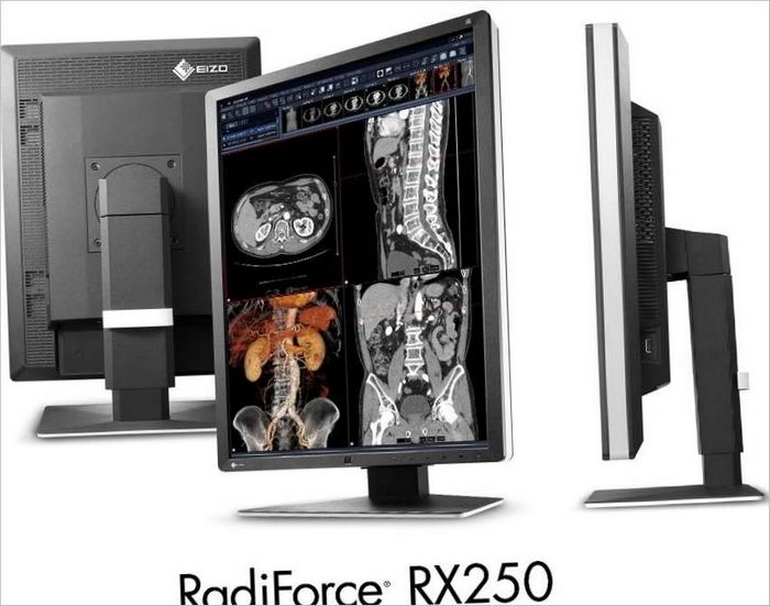 Monitori